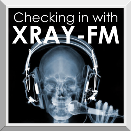 Feature- XRAY checkin